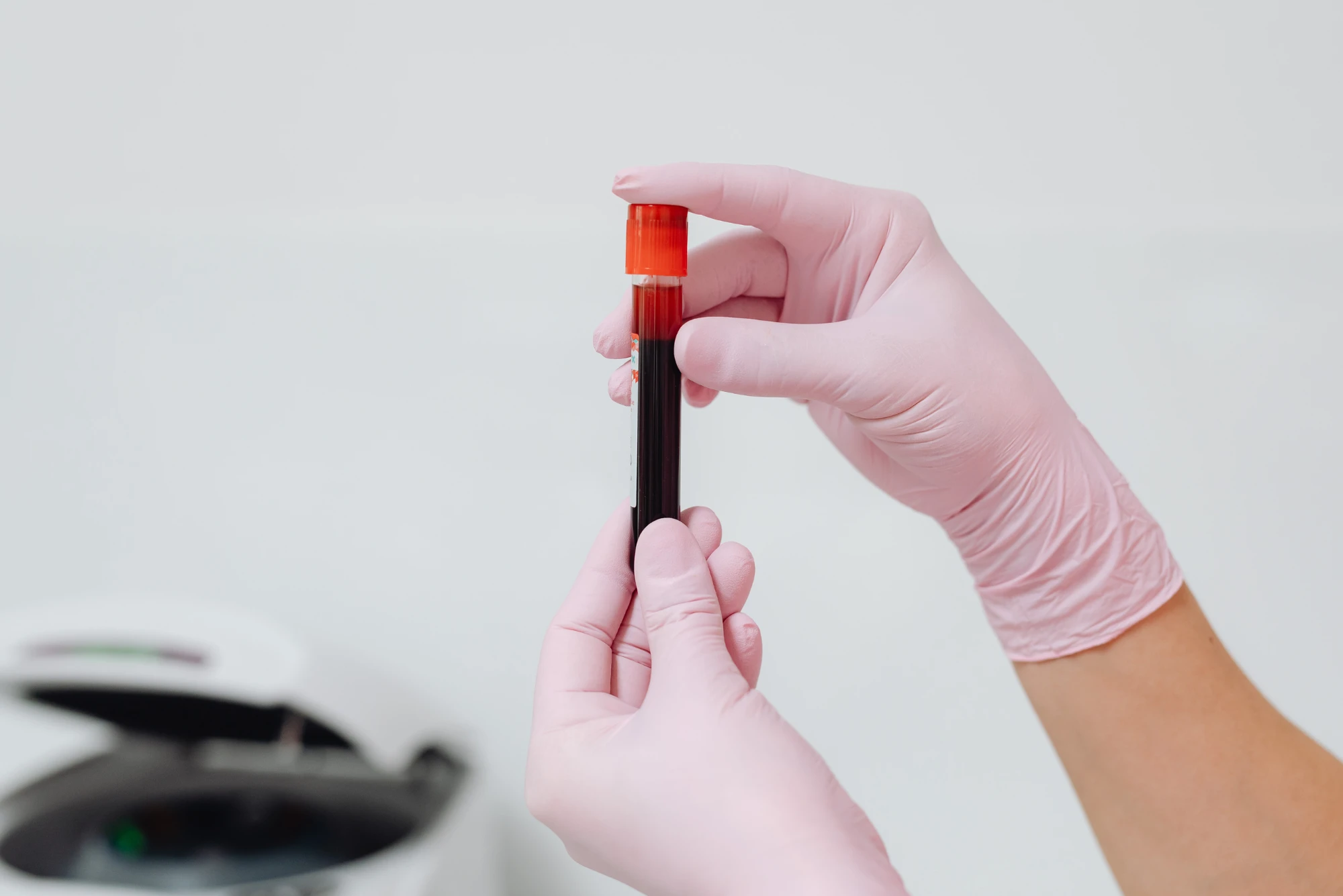A clinician in pink gloves holds a blood collection tube of dark blood in a lab, the sample type used for a multi-cancer early detection blood test.